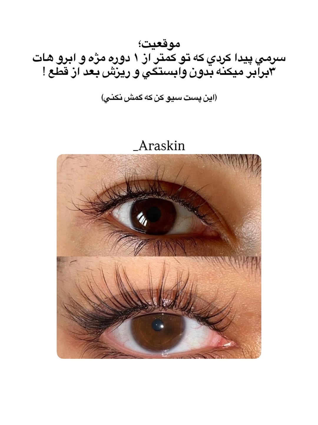سرم تقویت‌کننده مژه و ابرو